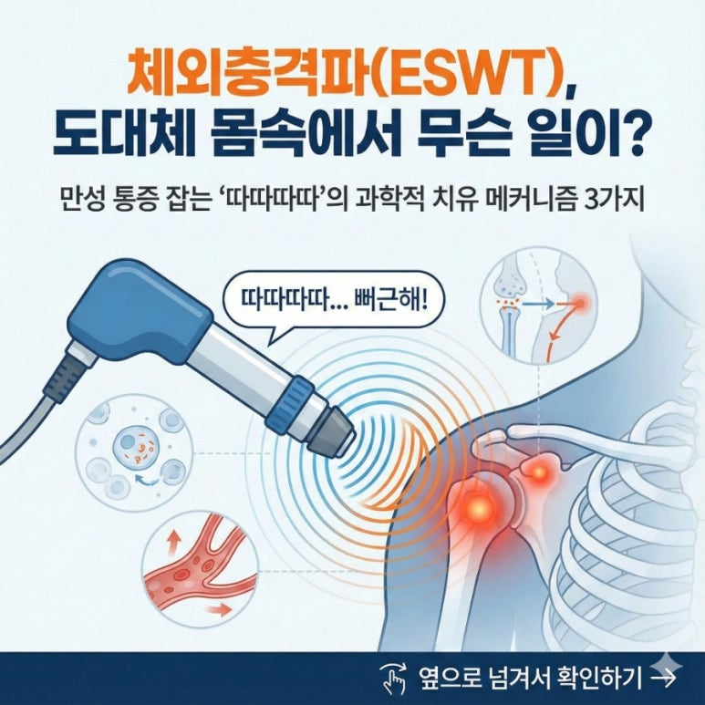 체외충격파(ESWT), 도대체 몸속에서 무슨 일이?