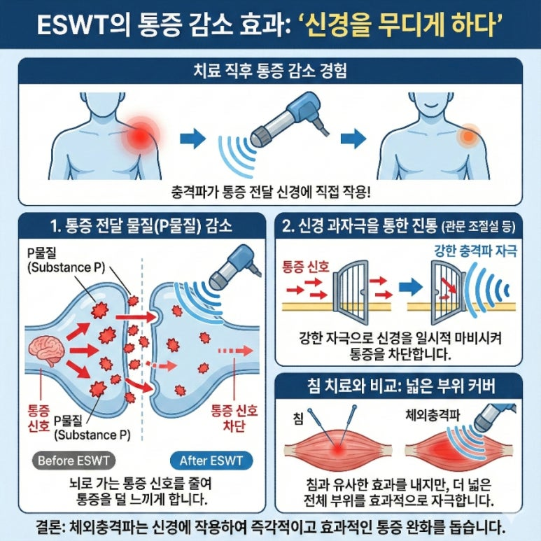 논문이 밝힌 과학적 원리 ③: 통증 감소 효과 — 신경을 무디게 하다