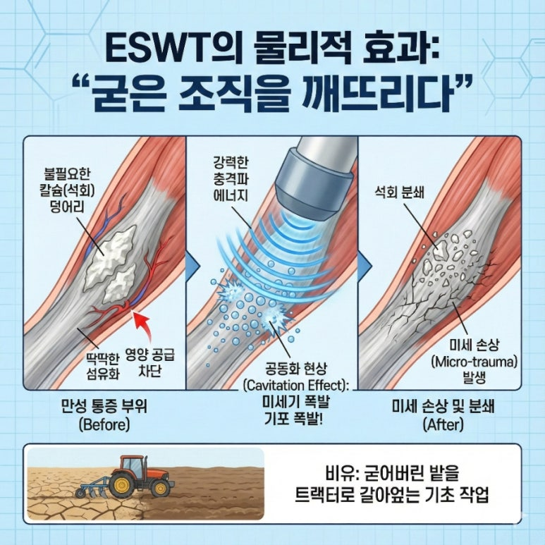 논문이 밝힌 과학적 원리 ①: 물리적 효과 — 굳은 조직을 깨뜨리다