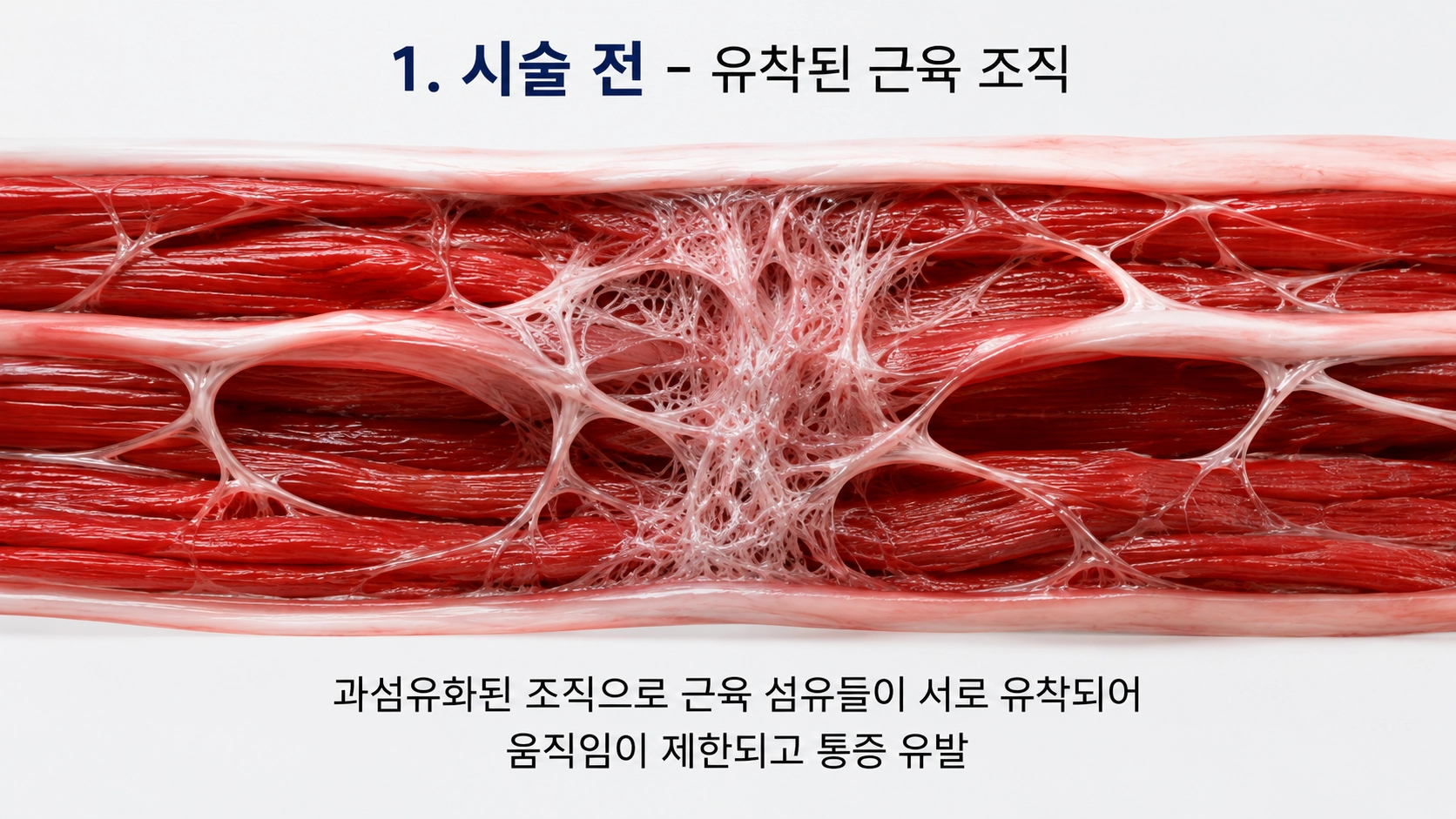 시술 전