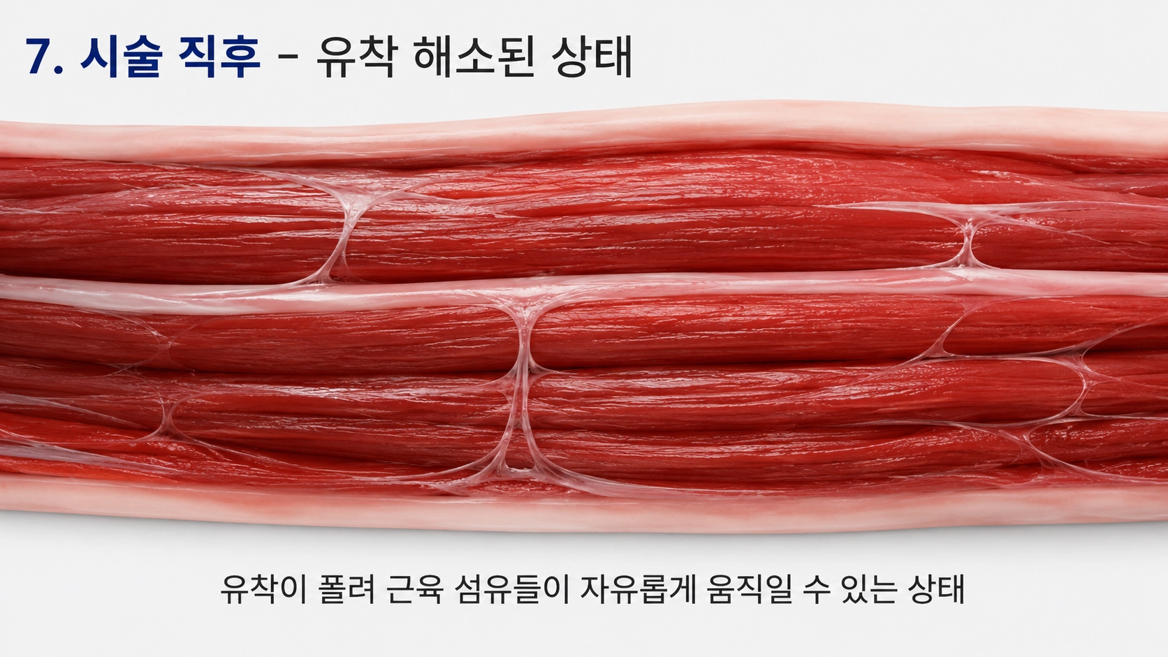 시술 직후