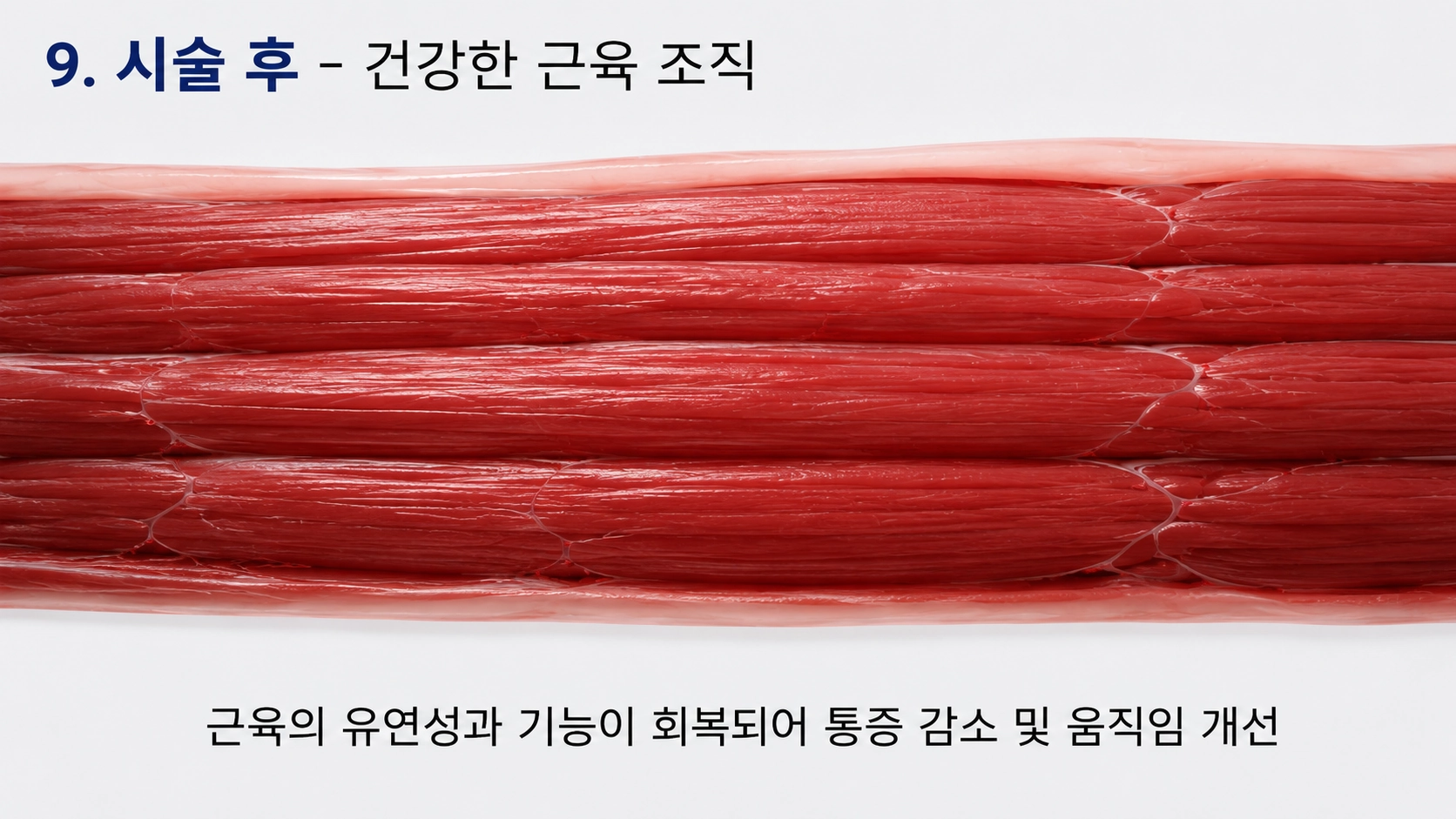시술 후